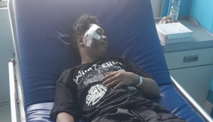 Tragis! Wahana Rumah Hantu di Majene Telan Dua Korban, Pengunjung Luka Parah di Wajah