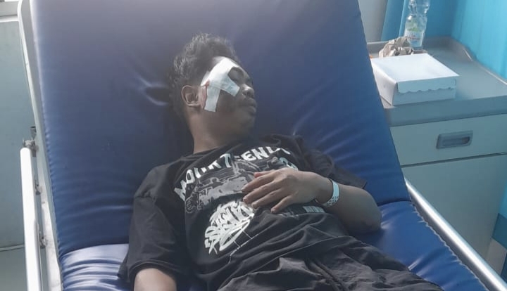 Tragis! Wahana Rumah Hantu di Majene Telan Dua Korban, Pengunjung Luka Parah di Wajah